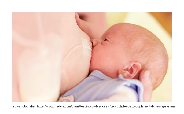 sns-supplementary-nursin-system-baby-breastfeeding